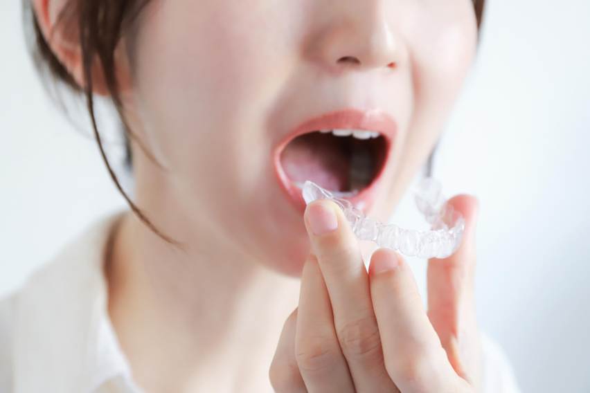 マウスピース矯正の期間はどのくらい？何カ月・何年かかるのか解説します