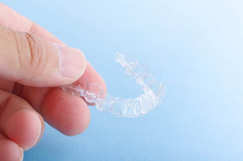 インビザラインのゴムかけって何？目的・タイミング・注意点まで詳しく解説！